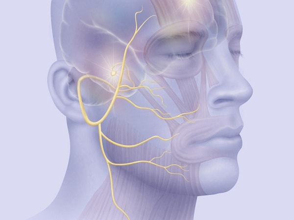 нейропатия лицевого нерва мкб