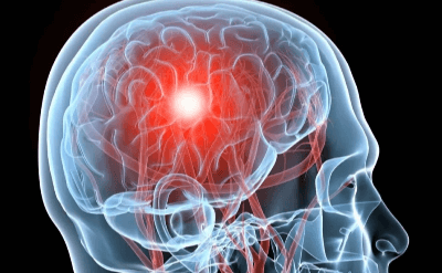 Закрытая черепно-мозговая травма: способы лечения сегодня