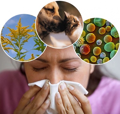 Аллергия неясной этиологии код мкб thumbnail